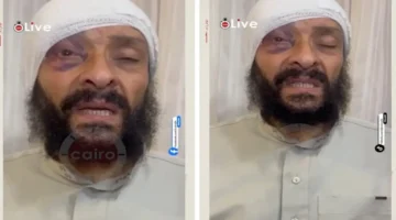 صدمة جديدة.. طبيب مصري يتعرض للسرقة بعد 30 سنة في السعودية